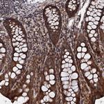 FAM111A Polyclonal Antibody