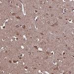 KCNG1 Antibody in Immunohistochemistry (Paraffin) (IHC (P))