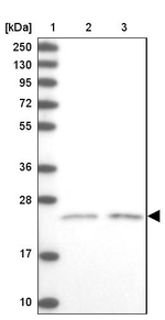 KCNG1 Antibody in Western Blot (WB)