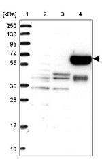 METTL25 Antibody in Western Blot (WB)
