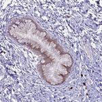 METTL25 Polyclonal Antibody