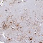 C12orf11 Polyclonal Antibody