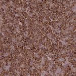 TNPO3 Antibody in Immunohistochemistry (Paraffin) (IHC (P))