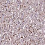 TAZ Antibody in Immunohistochemistry (IHC)