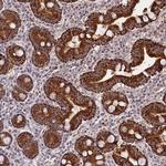 TAZ Antibody in Immunohistochemistry (IHC)
