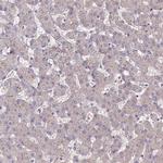TAZ Antibody in Immunohistochemistry (IHC)