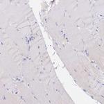 DONSON Antibody in Immunohistochemistry (Paraffin) (IHC (P))