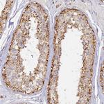 DONSON Polyclonal Antibody