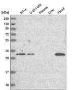 DONSON Antibody in Western Blot (WB)