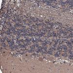 SUPT7L Polyclonal Antibody