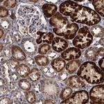 ALKBH7 Antibody in Immunohistochemistry (Paraffin) (IHC (P))