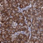 ALKBH7 Antibody in Immunohistochemistry (Paraffin) (IHC (P))