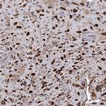ALKBH7 Antibody in Immunohistochemistry (Paraffin) (IHC (P))
