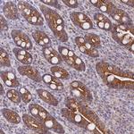 SACM1L Polyclonal Antibody