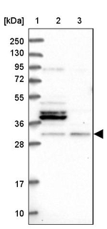 FUS2 Antibody in Western Blot (WB)