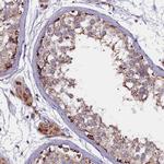 FUS2 Polyclonal Antibody