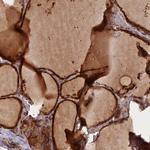 GMCL1 Polyclonal Antibody