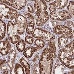 C3orf20 Antibody in Immunohistochemistry (Paraffin) (IHC (P))