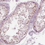 SPATA6L Antibody in Immunohistochemistry (IHC)