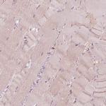 SPATA6L Antibody in Immunohistochemistry (IHC)