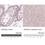 SPATA6L Antibody