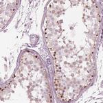 SPATA6L Antibody in Immunohistochemistry (IHC)
