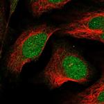 LSM11 Polyclonal Antibody