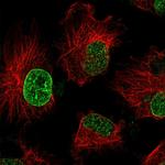 TBC1D19 Polyclonal Antibody