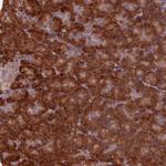 TBC1D19 Antibody in Immunohistochemistry (Paraffin) (IHC (P))