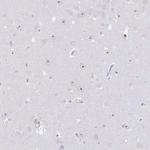 NOP14 Antibody in Immunohistochemistry (Paraffin) (IHC (P))