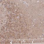 RGS7BP Polyclonal Antibody