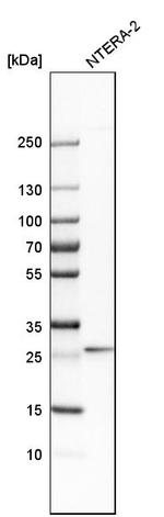 RGS7BP Antibody in Western Blot (WB)