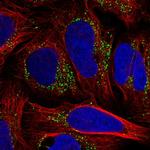 TM9SF3 Polyclonal Antibody