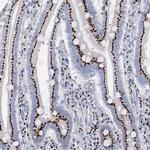TM9SF3 Antibody in Immunohistochemistry (IHC)
