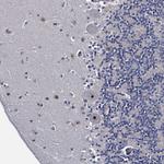 BXDC2 Antibody in Immunohistochemistry (Paraffin) (IHC (P))