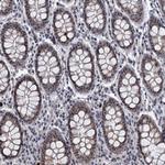 BXDC2 Antibody in Immunohistochemistry (Paraffin) (IHC (P))