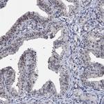 BXDC2 Antibody in Immunohistochemistry (Paraffin) (IHC (P))