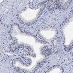 BXDC2 Antibody in Immunohistochemistry (Paraffin) (IHC (P))
