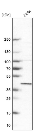 BXDC2 Antibody in Western Blot (WB)