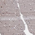 UBLCP1 Antibody in Immunohistochemistry (Paraffin) (IHC (P))