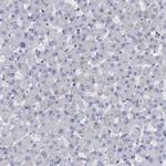 UBLCP1 Antibody in Immunohistochemistry (Paraffin) (IHC (P))