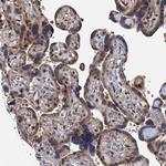 UBLCP1 Antibody in Immunohistochemistry (Paraffin) (IHC (P))
