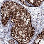 UBLCP1 Antibody in Immunohistochemistry (Paraffin) (IHC (P))