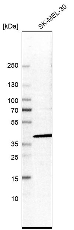 UBLCP1 Antibody in Western Blot (WB)