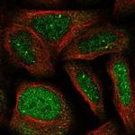 WDR19 Polyclonal Antibody