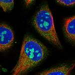 GTPBP4 Polyclonal Antibody