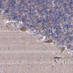 GTPBP4 Antibody in Immunohistochemistry (Paraffin) (IHC (P))