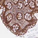 C11orf46 Antibody in Immunohistochemistry (Paraffin) (IHC (P))