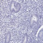 SCP3 Antibody in Immunohistochemistry (Paraffin) (IHC (P))