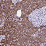 ERP27 Polyclonal Antibody